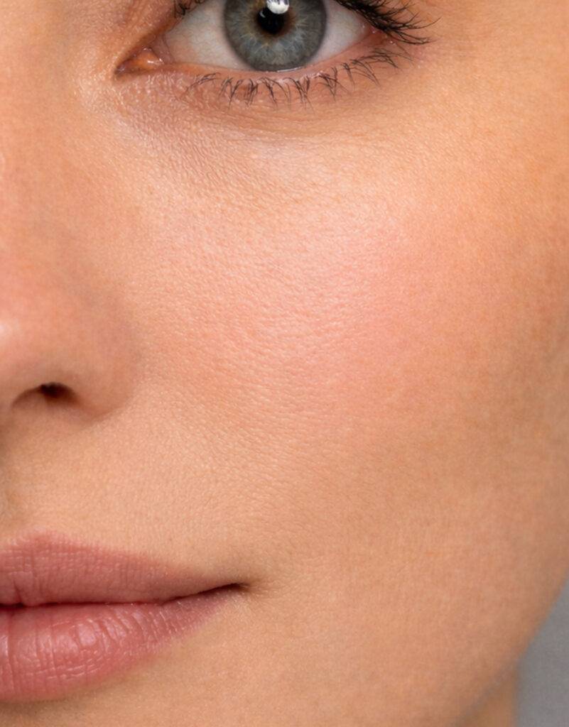 Close up of a woman's face after Botox services